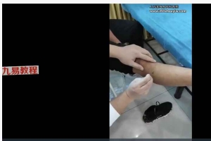 【天医神针】系列网课视频79集 百度云下载!