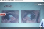 黄鑫古法观目术线上课视频17集 百度云下载！